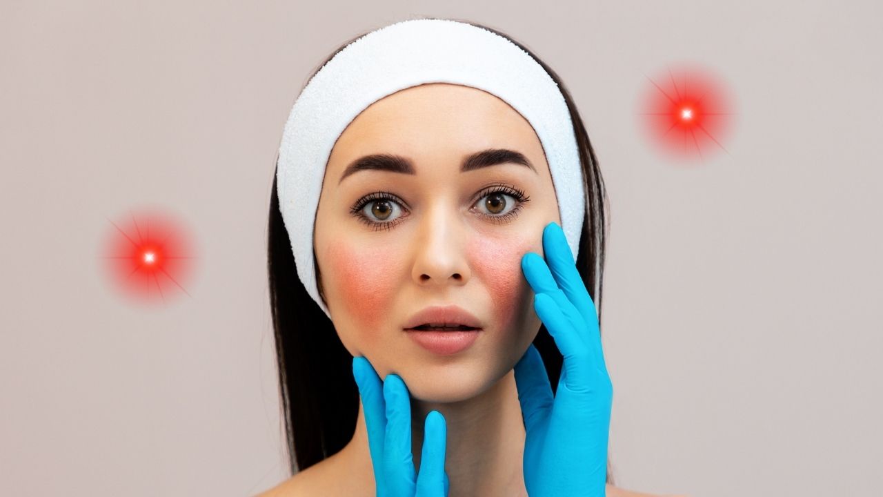 Do Infrared Saunas Cause Rosacea?